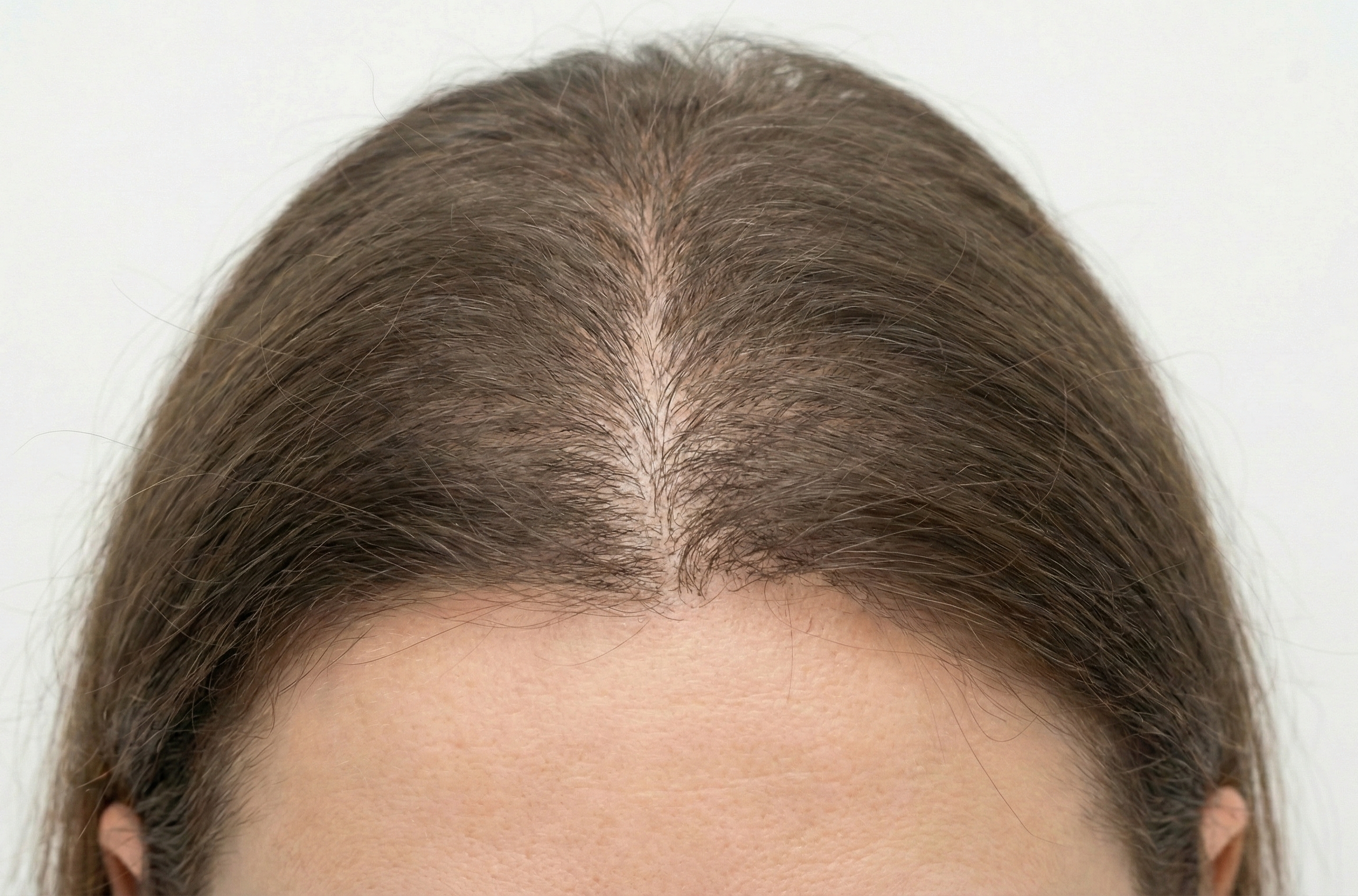 Depois de 5 meses de tratamento personalizado